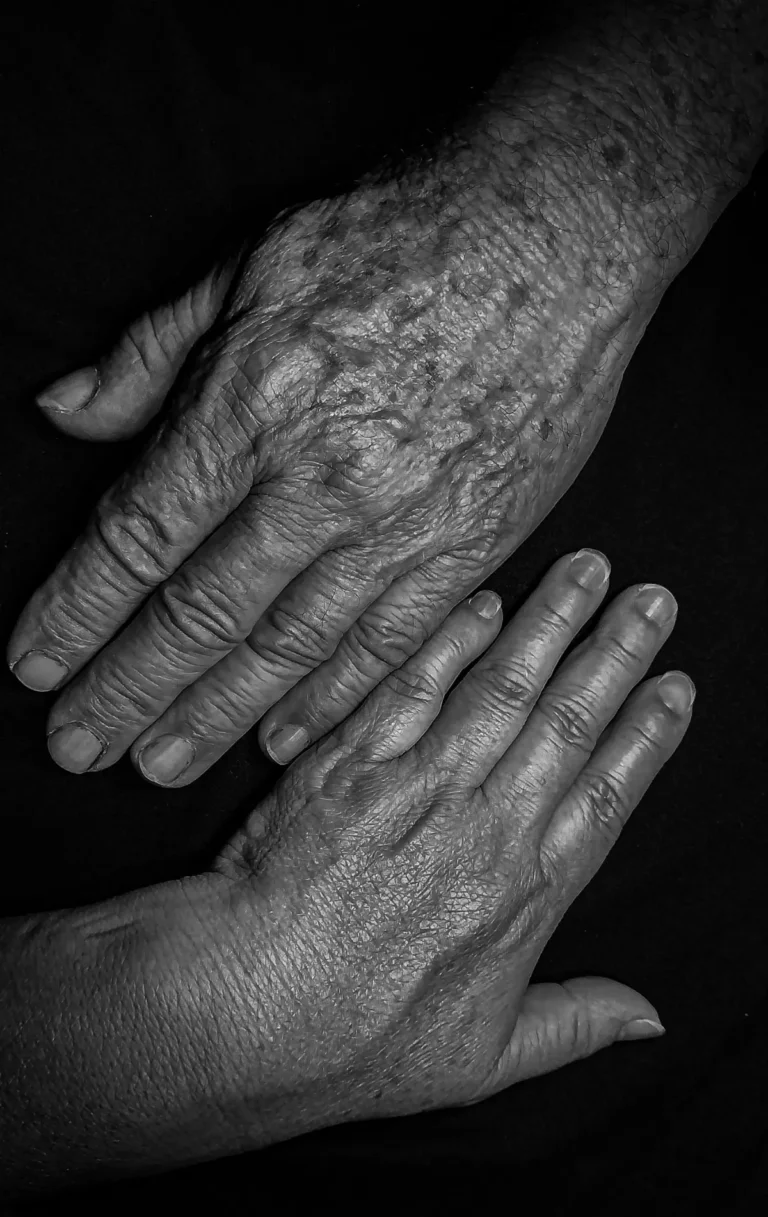 Mãos de uma pessoa idosa em repouso